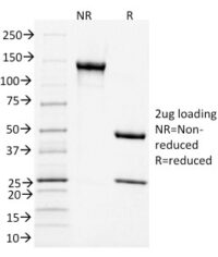 Data from SDS-PAGE analysis of Anti-CD3 antibody (Clone C3e/1931). Reducing lane (R) shows heavy and light chain fragments. NR lane shows intact antibody with expected MW of approximately 150 kDa. The data are consistent with a high purity, intact mAb.